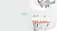 SANODENT